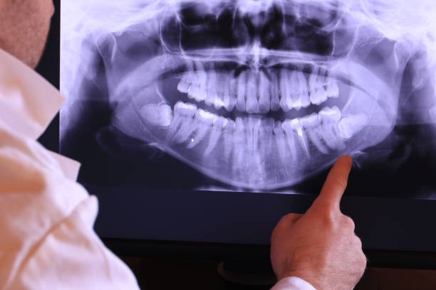 Best Cracked Tooth Emergency Dentist  in De Soto, IL